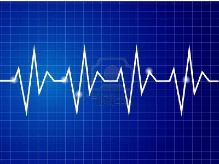 Het decoderen van het cardiogram is de meest betrouwbare diagnosemethode